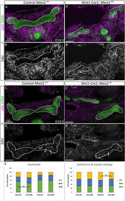 Meis2 controls skeletal formation in the hyoid region